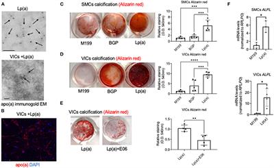 Lipoprotein(a) Induces Vesicular Cardiovascular Calcification Revealed With Single-Extracellular Vesicle Analysis